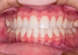 Igiene dentale professionale 8 Igiene dentale e prevenzione